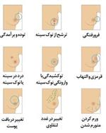 کنفرانس علمی تازه های تشخیص و درمان سرطان های هرتو مثبت پستان مورخ 12 شهریورماه در سالن هتل پارسیان