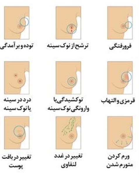 کنفرانس علمی تازه های تشخیص و درمان سرطان های هرتو مثبت پستان مورخ 12 شهریورماه در سالن هتل پارسیان